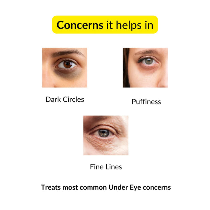 Eyecirque Under Eye Gel Serum for Dark Circles, Puffiness & Eye Bags - Eyecirque Store
