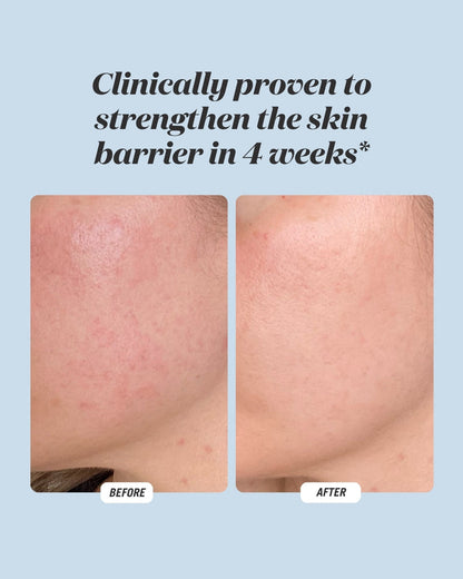 Before and after results for Common Clouds Cloud Drops hydrating serum, showing visibly calmer skin and a strengthened skin barrier after 4 weeks.
