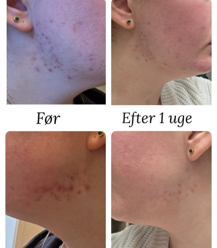 Natalie Maria Scandinavian | Calm Skin Nordic Nature drops - Hyaluronic serum