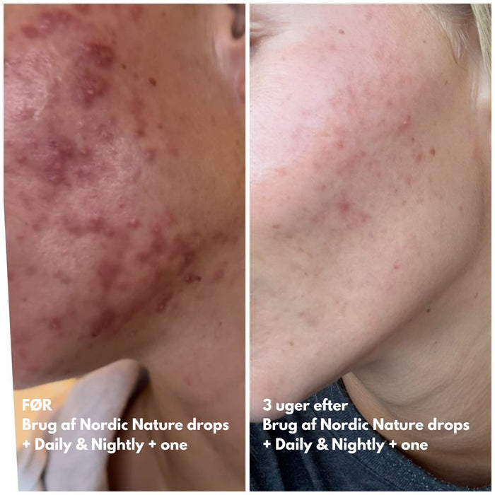 Natalie Maria Scandinavian | Calm Skin Nordic Nature drops - Hyaluronic serum